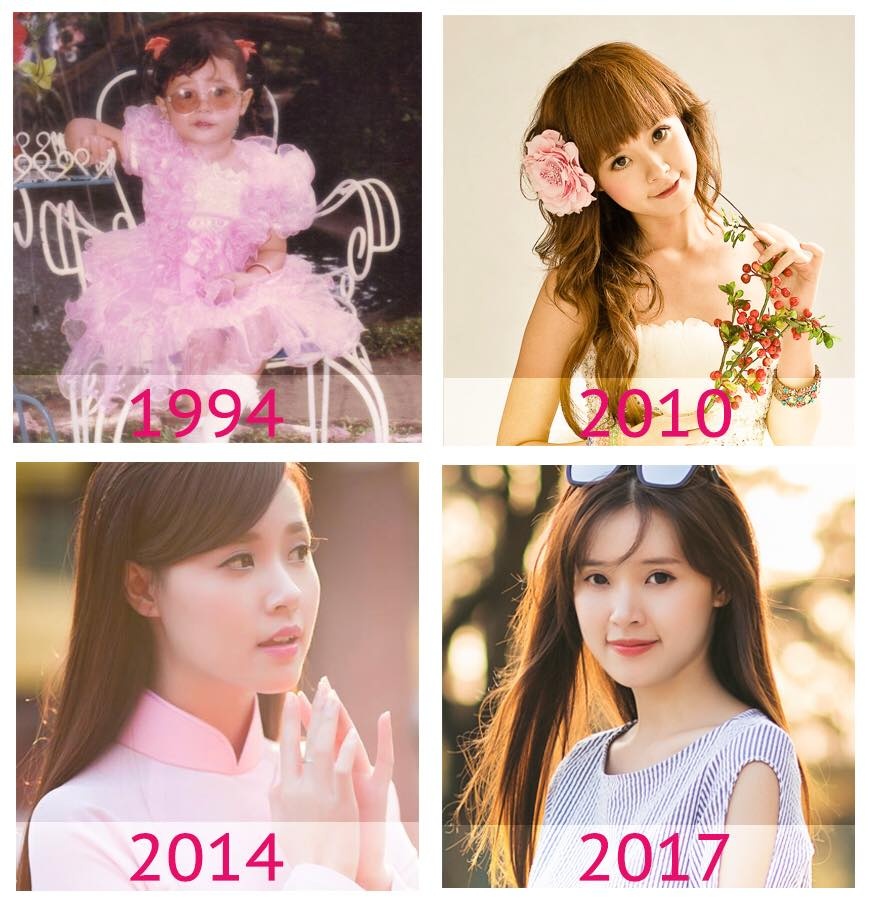 Midu phau thuat tham my anh 2