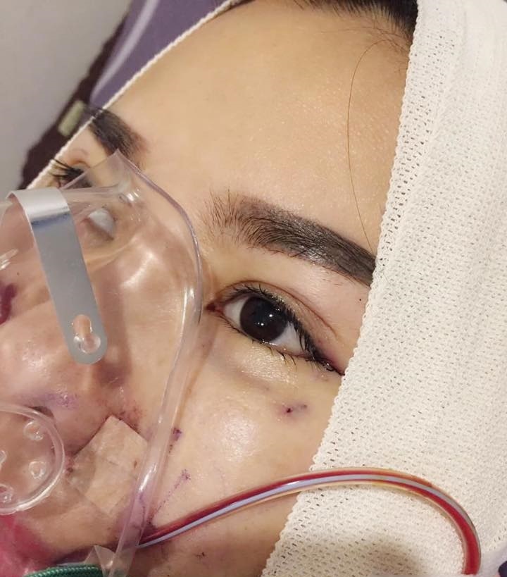 Que Van cong khai phau thuat tham my anh 3