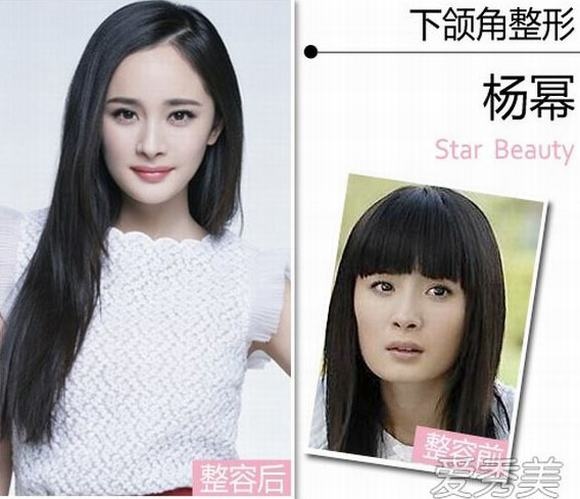 Sao Trung Quốc thảm họa thẩm mỹ ảnh 4 Sao Trung Quoc tham hoa tham my anh 4