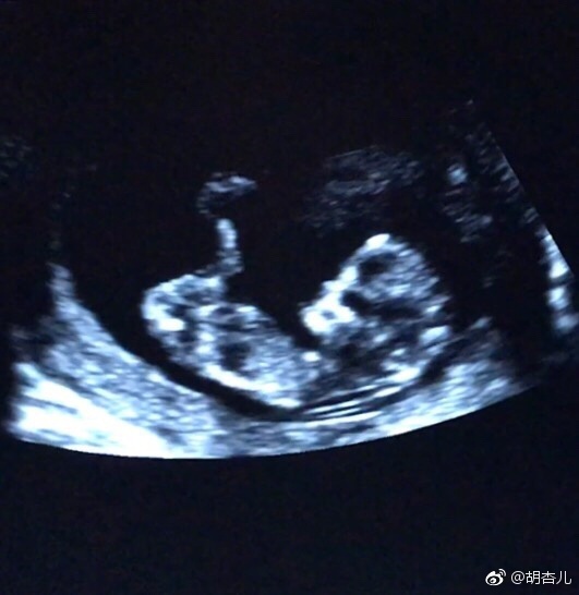 Ho Hanh Nhi mang thai anh 1