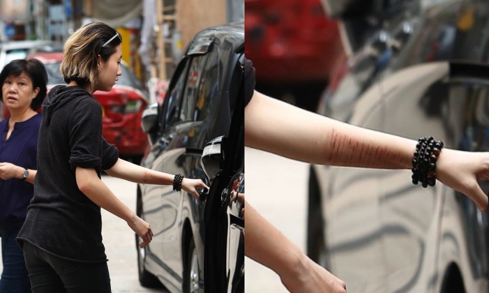 Con gái Thành Long lộ tay chi chít vết rạch ảnh 2 Con gai Thanh Long lo tay chi chit vet rach anh 2