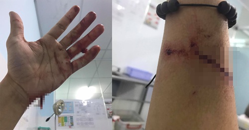 Ca si Dong Hung to me no nan anh 2