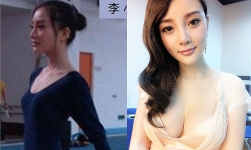 Lý Tiểu Lộ thẩm mỹ ảnh 1 Ly Tieu Lo tham my anh 1