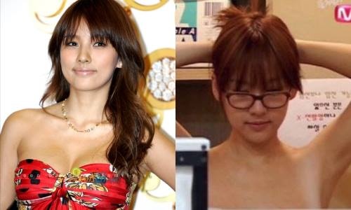 3 sao nu Han cong bo bang chung khong phau thuat tham my hinh anh