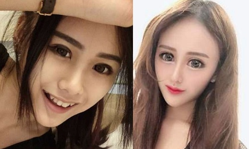 Nguoi mau 22 tuoi bi che la 'xa tinh dang so' sau phau thuat tham my hinh anh