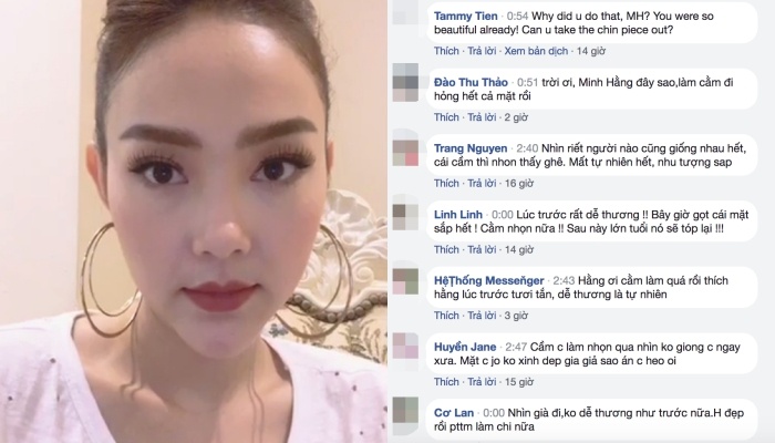 Minh Hằng cằm nhọn ảnh 1 Minh Hang cam nhon anh 1