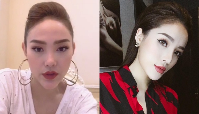 'Cuoc chien' dao keo khien cac my nhan Viet ngay cang giong nhau hinh anh