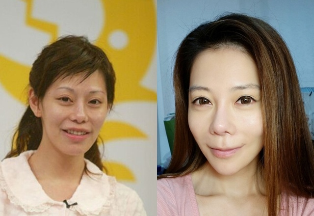 MC Đài Loan 60 lần thẩm mỹ ảnh 2 MC Dai Loan 60 lan tham my anh 2