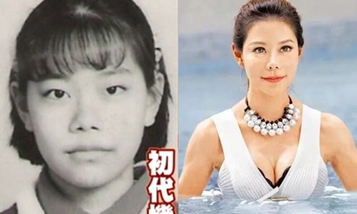 MC Dai Loan bi nhieu bien chung sau 60 lan phau thuat tham my hinh anh