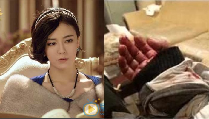 Lữ Giai Dung tự sát ảnh 1 Lu Giai Dung tu sat anh 1