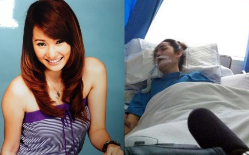 Sao châu Á chết vì phẫu thuật thẩm mỹ ảnh 2 Sao chau A chet vi phau thuat tham my anh 2