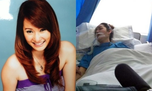 Nhung nghe si tre chau A tu vong sau phau thuat tham my hinh anh