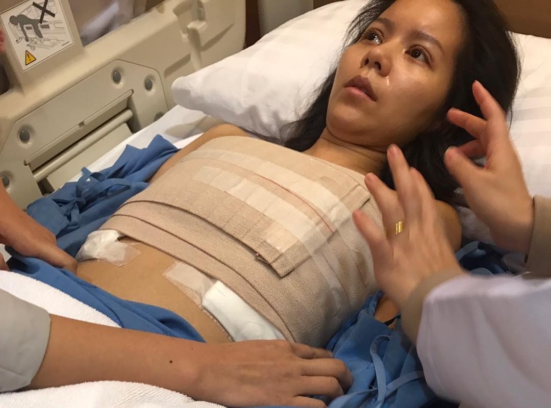 Ca sĩ Thái Lan nâng ngực hỏng ảnh 1 Ca si Thai Lan nang nguc hong anh 1