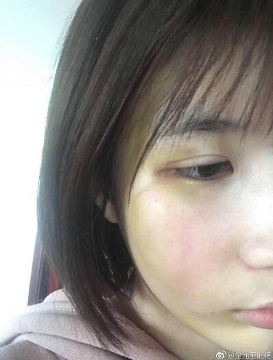 Sao nam Dien Hi cong luoc be boi anh 2