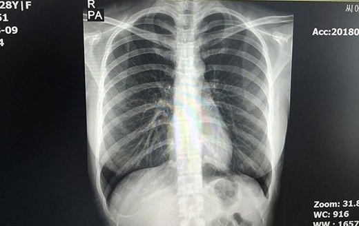 Người mẫu Hàn tung bằng chứng không nâng ngực ảnh 2 Nguoi mau Han tung bang chung khong nang nguc anh 2