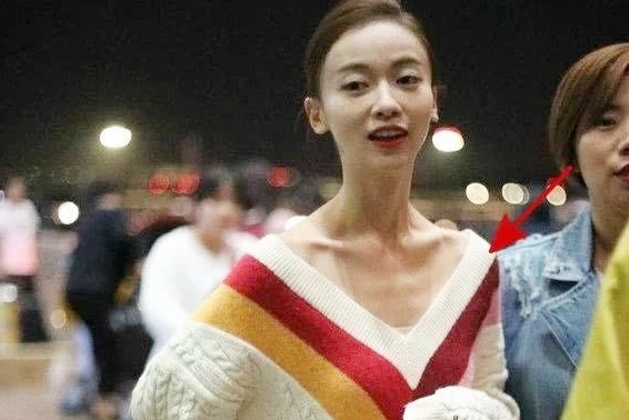 'Nguy Anh Lac' Ngo Can Ngon ngay cang gay go, nhu da boc xuong hinh anh