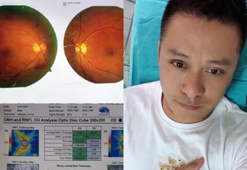 Tuan Hung bi thuong anh 1