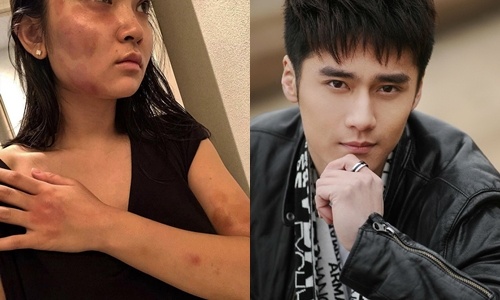 My nam 9X Trung Quoc bi len an vi bao hanh ban gai hinh anh