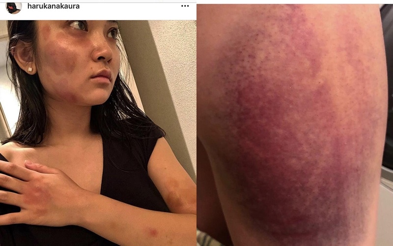 Tưởng Kính phu đánh đập bạn gái ảnh 1 Tuong Kinh phu danh dap ban gai anh 1