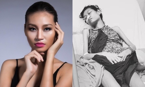 Nguoi mau 9X Viet mac benh ung thu buong trung giai doan cuoi hinh anh