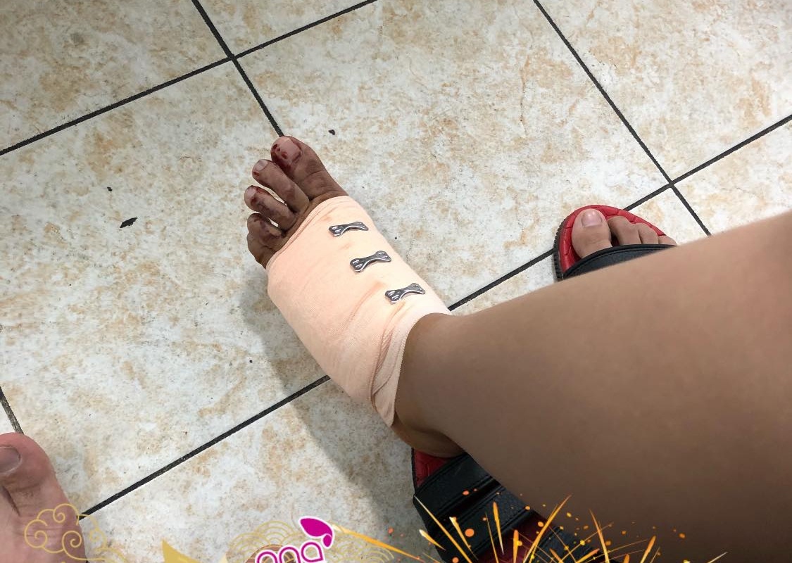 Phan Manh Quynh khien ban gai hot girl bi tai nan anh 2