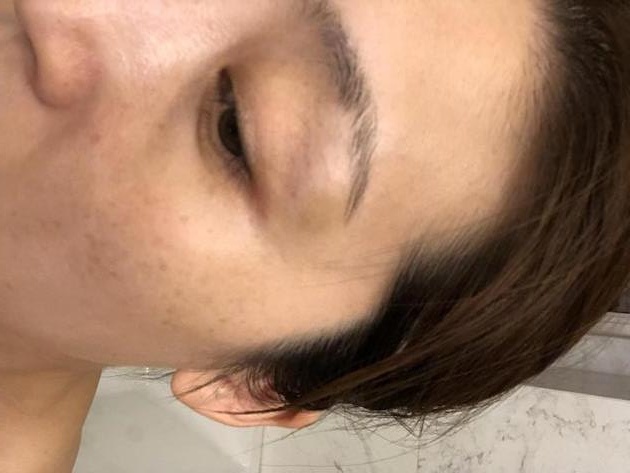 Chau My Nghi bi chong bao hanh anh 2