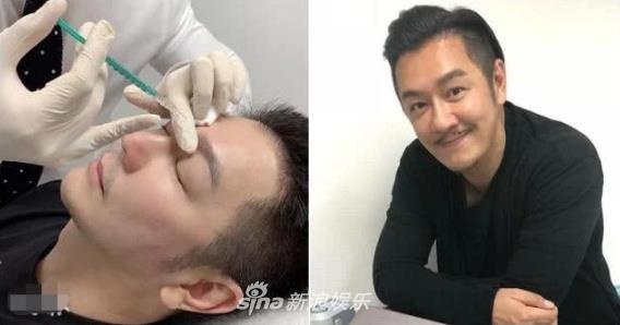 'Doan Du' Tran Hao Dan tham my de tre trung o tuoi anh 1