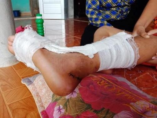 Hoc sinh dut gan chan, hieu truong noi chuyen co gi lon ma lam am len hinh anh