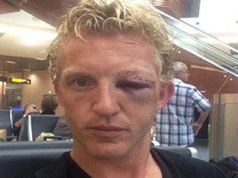 Dirk Kuyt bam tim  mat sau pha va cham kinh hoang hinh anh