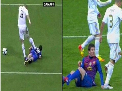 Nhung pha triet ha doi thu mang thuong hieu Pepe hinh anh