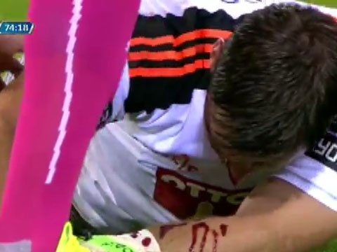 Mat be bet mau sau pha va cham kinh hoang hinh anh