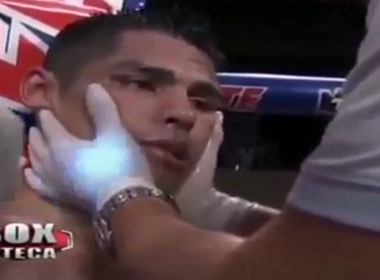 Vo si tu vong sau 3 ngay bi ha knock-out hinh anh