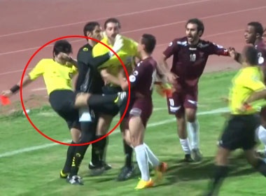 Trong tai noi dien sau khi bi cau thu doa hinh anh