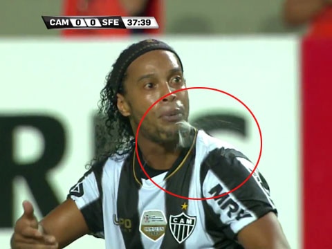 Hinh anh phun mua xau xi cua Ronaldinho hinh anh