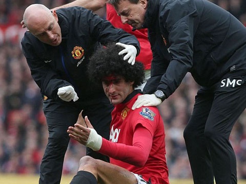 Pha va cham voi Gerrard khien Fellaini do mau hinh anh