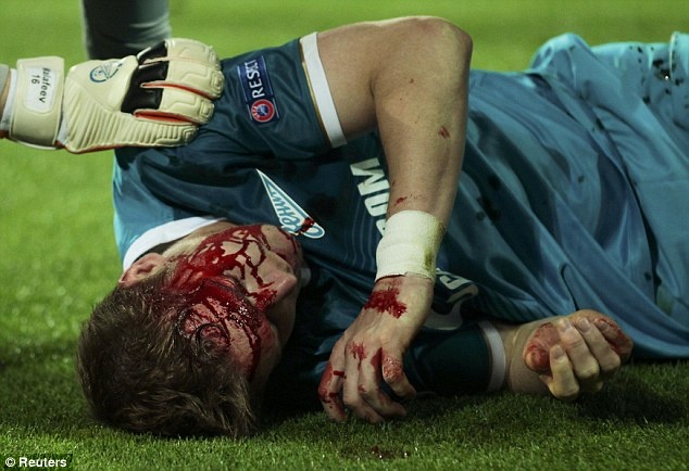 Mau do trong tran Dortmund tiep don Zenit hinh anh