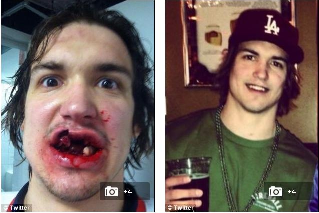 Callahan sau và trước khi ăn trọn trái bóng của đồng đội. Ảnh Twitter Callahan