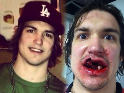 Mat 10 cai rang, vo ham vi cu danh cua dong doi hinh anh