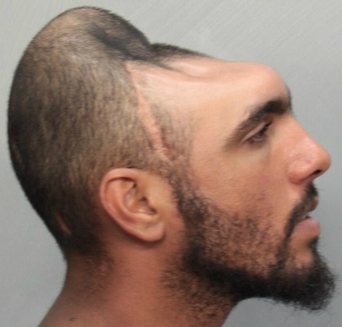 Nhung truong hop song sot ky la sau tai nan hinh anh