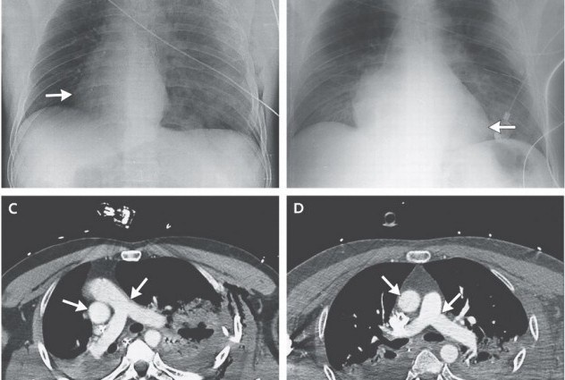 Ảnh X quang và chụp cắt lớp