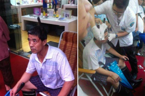 Dao roi trung dau van than nhien dao pho hinh anh