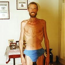 Ricky Megee trong như một bộ xương biết đi sau 3 tháng lạc ở Outback. Ảnh: Mixstuff