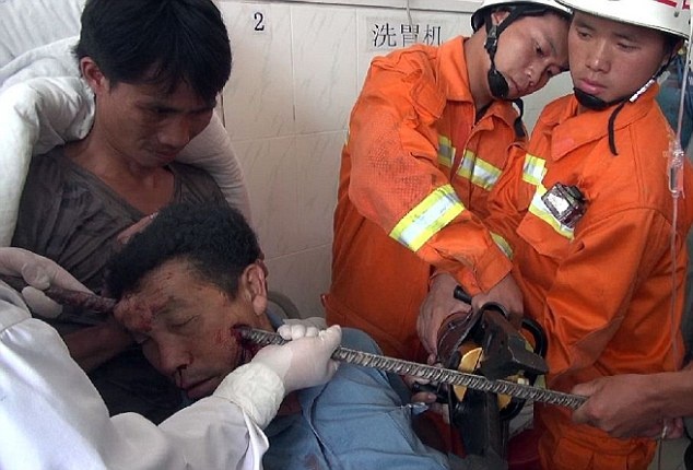 Linh cuu hoa cat mot phan thanh sat cam xuyen dau nan nhan hinh anh