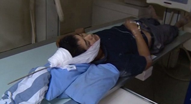 Tho xay thoat chet sau khi bi dien giat va sat dam xuyen dau hinh anh