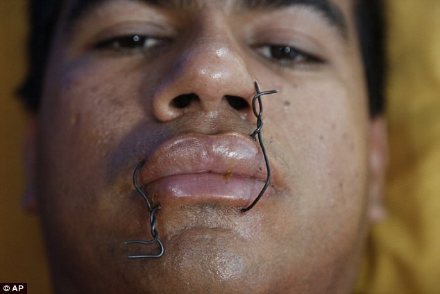 Tai xe khau mieng va dong dinh sau khi mat viec hinh anh