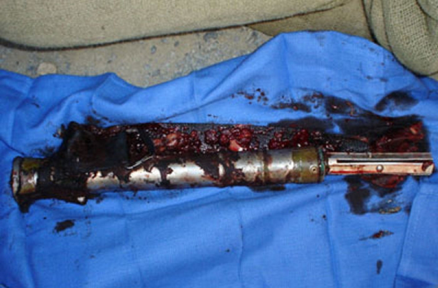 10 vat the ky quai tung lot vao co the nguoi hinh anh