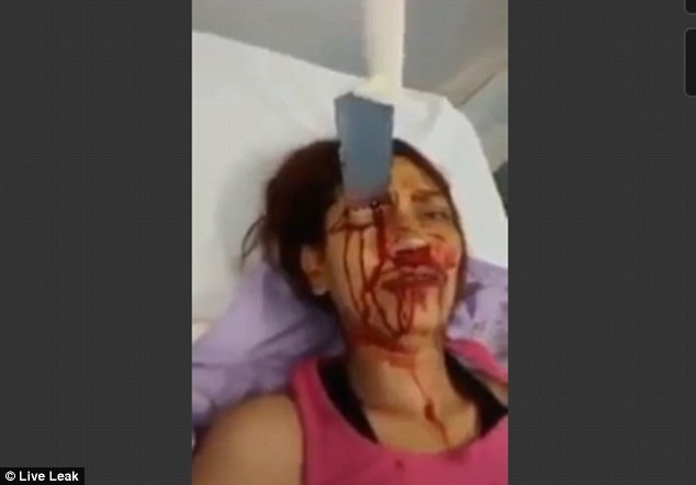 Nan nhan van tinh tao to cao hung thu hinh anh