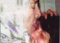 Nguoi dan ba bi an dung luoi chua benh ve mat hinh anh