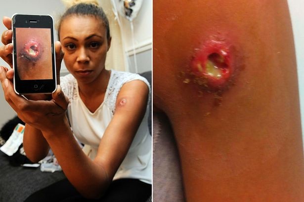 Tay co gai liet vi nhen can hinh anh