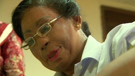 Một số nạn nhân